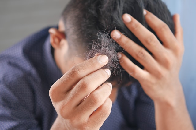 uomo con in mano capelli che cadono