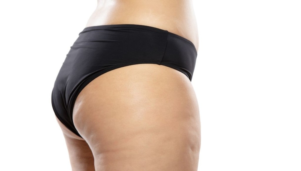 donna che si chiede come eliminare la cellulite dai glutei