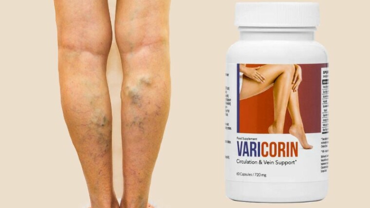 gambe con vene varicose con integratore